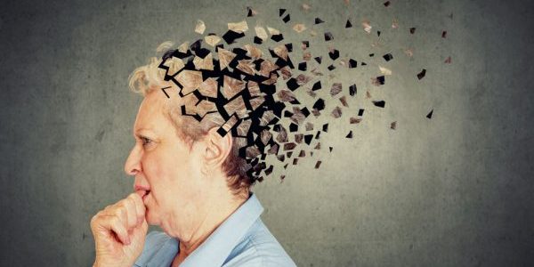alzheimer